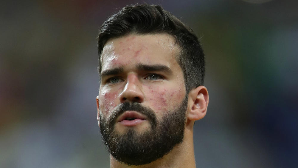 Liverpool Complete £67M Alisson Becker Deal From Roma